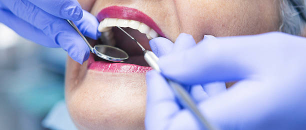 Best Emergency Dental Care for Broken or Chipped Teeth in Yutan, NE